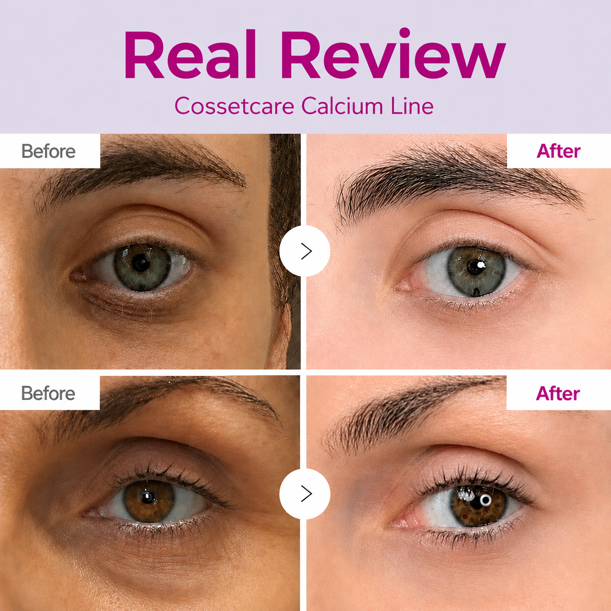 🔥LAST DAY 50% OFF!!Cougex Korean Calcium Dark Spot Eye Cream